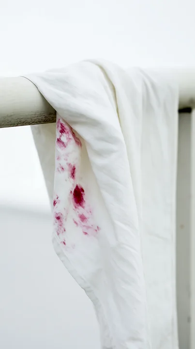 A white cloth with a visible stain is draped over a light-colored railing.